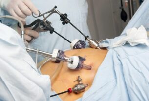 Gastric Sleeve Journey